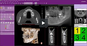 iRYS 11 Reports - Generating A Report