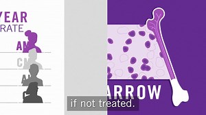 Recently, the FDA approved our medicine as a treatment for certain people with newly-diagnosed acute myeloid leukemia (AML) or those who are ineligible for intensive induction chemotherapy. Watch the video below to learn about #AML, the most common type of aggressive #leukemia in adults. http://ow.ly/FEra50jL2ZM | Genentech