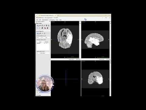 Biomedical Image Analysis Part 1 — Working with DICOM files 👩‍⚕️👩‍💻