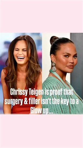 Glow up on Instagram: "The biggest glow ups aren’t from filler or surgery. Most women think they need drastic changes to look amazing but the truth is, subtle, well-placed tweaks can completely transform your look. Think: 👉🏻The perfect brow shape that frames your face A hair colour that complements your skin tone 👉🏻Makeup shades that enhance your natural glow 👉🏻These small changes are often all it takes to look radiant, balanced, and effortlessly put together without ever touching a needle