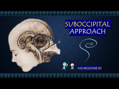 Suboccipital Approach