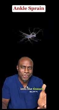 Ankle Sprain - What’s Really Going On?