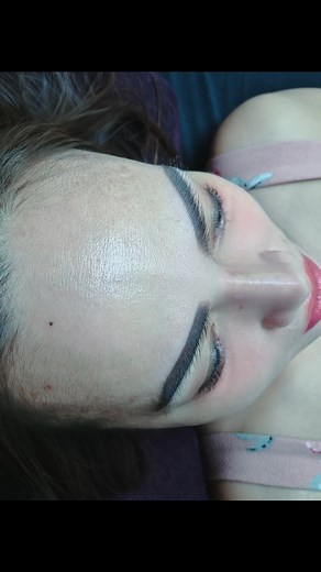 💖 Nose Thread Lift (HIKO PCL) 💖 Want a higher, slimmer, and more defined nose without surgery? 👃✨ Try the Korean HIKO PCL Nose Thread Lift — instant lift, natural shape, and long-lasting results! 💎 No pain. No downtime. Just beauty. 💫 📍 Venus Beauty Clinic – Dubai 📞 0559941868 | DM to book your free consultation today! #VenusBeautyClinic #NoseThreadLift #HIKOPCL #KBeautyDubai #NonSurgicalNoseLift #InstantLift #DubaiBeauty #3DNose #NaturalBeauty | Venus Beauty Clinic