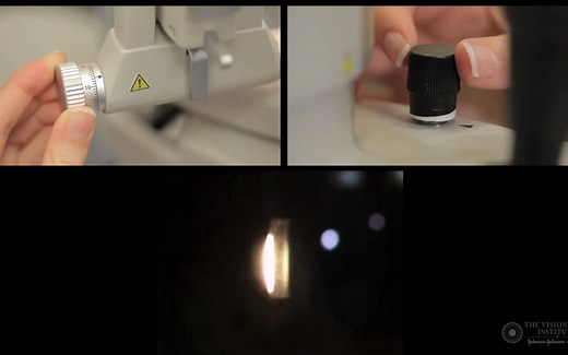 【中英双字】【裂隙灯镜面反射法观察角膜内皮】Slit Lamp Techniques-Specular Reflection