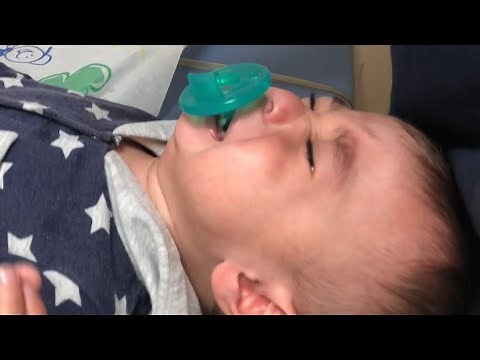 Baby revision circumcision