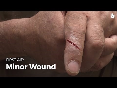 Learn first aid gestures: Minor Wound