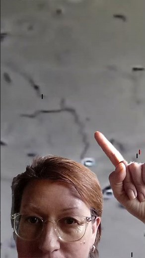 What dental plaque looks like under a microscope.