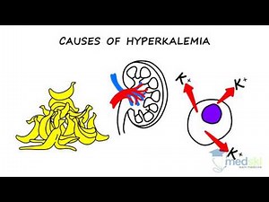 Internal Medicine – Hyperkalemia: By Ben Schelew M.D.
