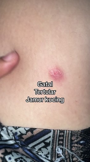 Atasi Jamur Kucing: Panduan Lengkap Mengobati dan Mencegah