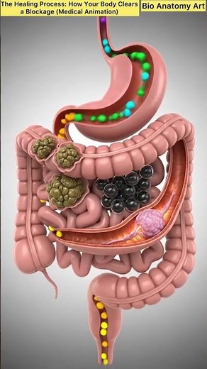 The Healing Process: How Your Body Clears a Blockage (Medical Animation)|Bio Anatomy Art| Gut Health