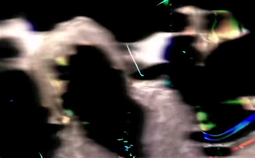 Trippie Redd - In Too Deep (Official Music Video)