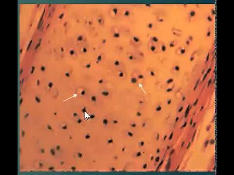 Chondrocytes in lacunae