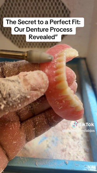 The Secret to a Perfect Fit: Our Denture Process Revealed”Discover the secret behind a perfect denture fit! Our denture process is carefully designed to create beautiful, comfortable, and natural-looking results. From precise impressions to detailed craftsmanship, we ensure every denture is customized just for you. Say goodbye to discomfort and hello to a confident smile! Watch the full journey unfold in this video.DentureCare #SmileTransformation #CustomDentures #PerfectFitSmile #DentureJourney