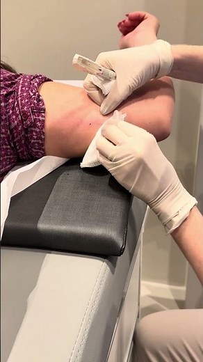 Implanon insertion in practice