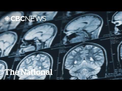 Why these portable brain scanners are being called a 'game changer'