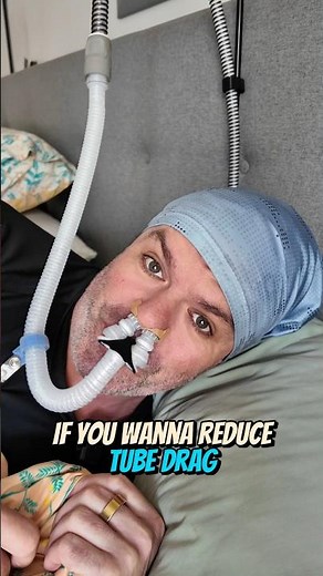 The CPAP Hose Trick Everyone Should Know 🤫