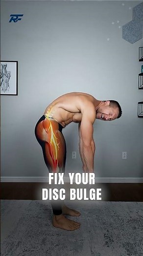 Disc Bulge? Stop Stretching and Do This Instead (3-Step Fix)