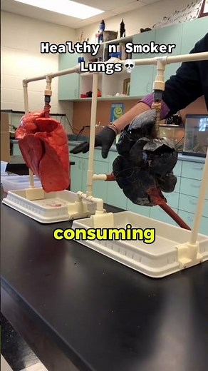 Healthy vs Smoker’s Lungs