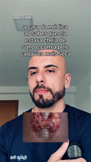 Passar mais tempo na cama não garante que o corpo esteja realmente descansando. . Quando o hipotireoidismo está presente, a desaceleração do organismo pode provocar fadiga, fraqueza, movimentos mais lentos e dificuldade de concentração. A pessoa pode interpretar tudo isso como preguiça ou sono, embora esteja lidando com uma falta persistente de energia. . O sono se torna mais sugestivo de hipotireoidismo quando não aparece sozinho. Sentir frio até em ambientes quentes, ficar com o intestino pres