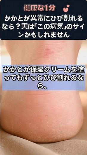What if your heels are cracked abnormally? It might actually be a sign of "this condition" #crack...
