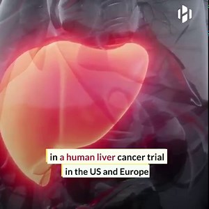 Scientists destroy cancer cells using sound waves. | Hashem Al-Ghaili