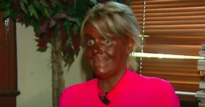 La mère bronzée Patricia Krentcil est différente après avoir changé de vie suite à un excès de bronzage qui a failli lui coûter la vie