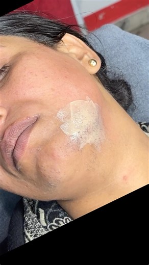 Hard hair growth chin waxing tutorial/ #waxing #chinwaxing #hairremoval #skincare @pummybeautyworld