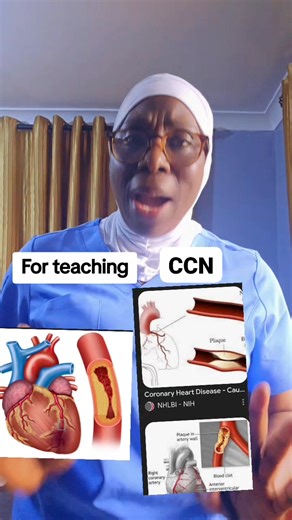 30K views · 915 reactions | CARDIAC PROBLEMS. HEART FAILURE IS DIFFERENT FROM HEART ATTACK. | Couples Connect Network By Sister Mariam Balogun | Facebook