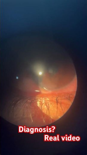 Diagnosis || Optometry solutions