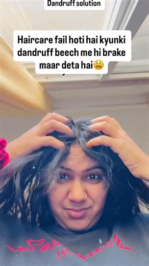 Sarita Choudhary | Hair & Skin care on Instagram: "Comment for products link 🔗 Winter me dandruff 2× badh jata hai kyunki scalp dry ho kar flakes push karta hai. Agar aapka bhi scalp itchy + white flakes wala ho raha hai, to ye simple routine follow karo ⬇️ 1. Pre-wash: Scalp Oil Barrier Coconut ya rosemary oil ko sirf 20–30 min ke liye scalp par lagao — ye dryness ko control karta hai. 2. Shampoo: Anti-dandruff + Hydrating Combo Har 3rd wash me anti-dandruff shampoo use karo aur baaki days gen