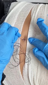 Doctors didn't expect the horrifying thing that came out of her belly button 😨 | Southern Sketch Comedy