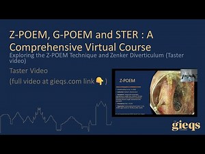 Exploring the Z-POEM Technique and Zenker Diverticulum (Taster video)
