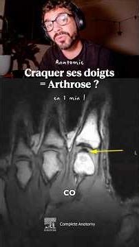 Craquer tes doigts = Arthrose ?! ENFIN la vérité 🦴💥 #anatomie #science #arthrose #corpshumain
