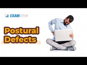 Postural Defects