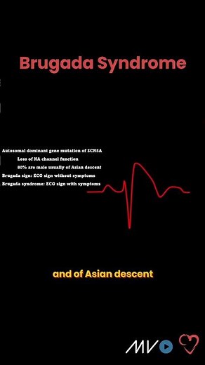 Brugada Syndrome