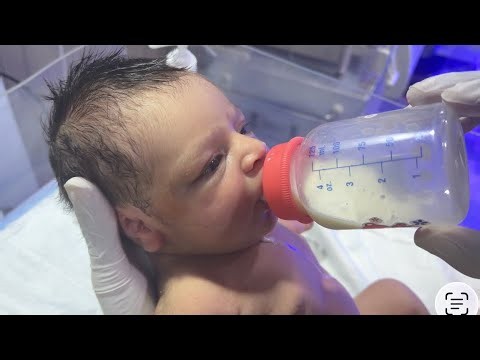 Little Baby in NICU | Proper Feeding Guide #cute #baby #newborn