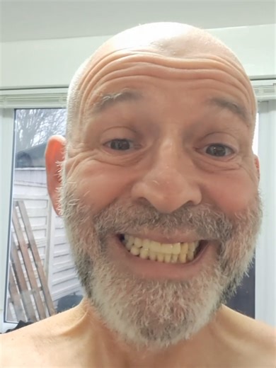 Two Weeks with My Partial Denture: Progress Update