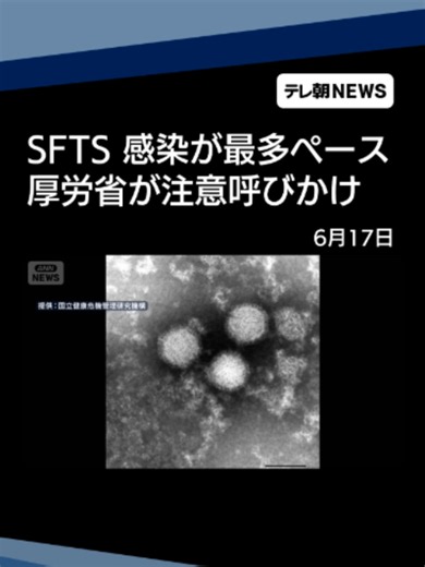 マダニが主な感染源「SFTS」 72人が感染 過去最多ペース 注意呼びかけ #テレ朝NEWS #tiktokでニュース