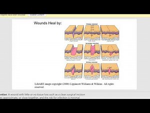 Skin Integrity and Wound Care