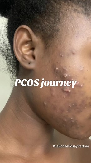 Flora Yapi on TikTok