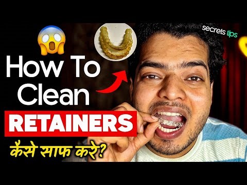 Retainers Ko Kaise Saaf Kare | How To Clean Removable Retainers | Braces Journey |