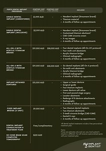 Cost of Dental Implants Perth @ $3,999 Per Tooth Implant