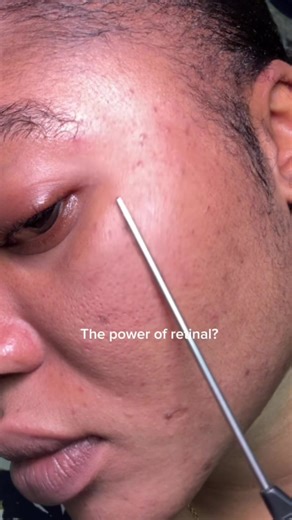 Korean Skincare Secrets Revealed: Advanced Techniques from 1988