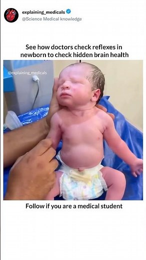 See how doctors 😷 check reflexes in newborn to check hidden brain health 🩺