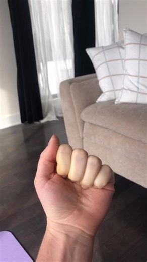 Understanding Raynaud's Syndrome: Causes, Symptoms, and Treatment