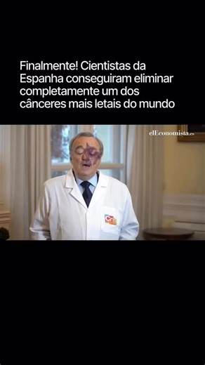 Eu Sérgio Abreu on Instagram: "Pesquisadores do Centro Nacional de Investigações Oncológicas (CNIO), na Espanha, liderados por Mariano Barbacid, alcançaram algo inédito: a eliminação total de tumores de câncer de pâncreas em modelos animais usando uma combinação estratégicą de três medicamentos. A terapia atua diretamente nos tres principais mecanismos que tornam esse câncer tão agressivo e resistente: o gene KRAS (presente em cerca de 90% dos casos), o receptor EGFR e a via STAT3, responsável p