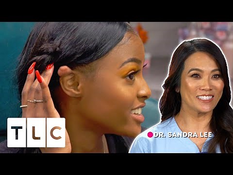 Dr. Lee Helps Teenager With 'Cutest' Keloids She's Ever Seen | Dr Pimple Popper: Pop Ups