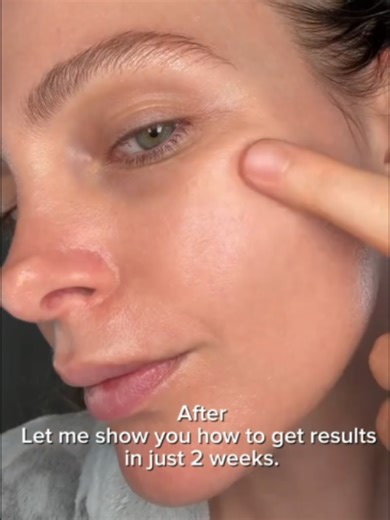 Skincare Routine Pemula: Langkah Self Care Harian