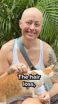 The hardest part of my cancer diagnosis? MY HAIR LOSS!
