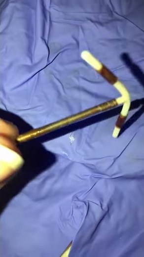 Paragard IUD After Removal